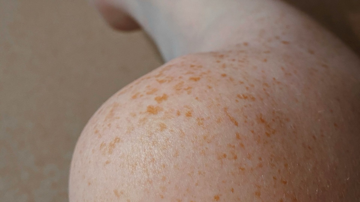 5 Reasons To Never Skip Sunscreen