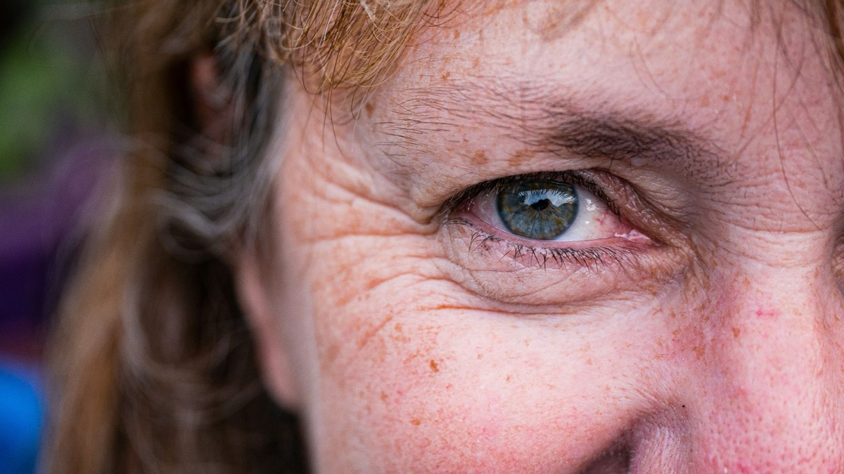 5 Reasons To Never Skip Sunscreen