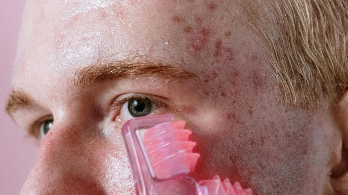 5 Reasons To Never Skip Sunscreen